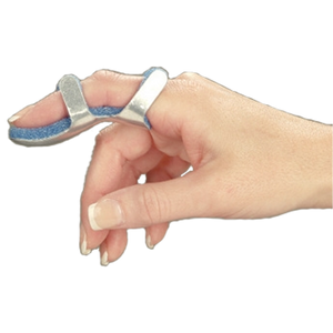 Splints