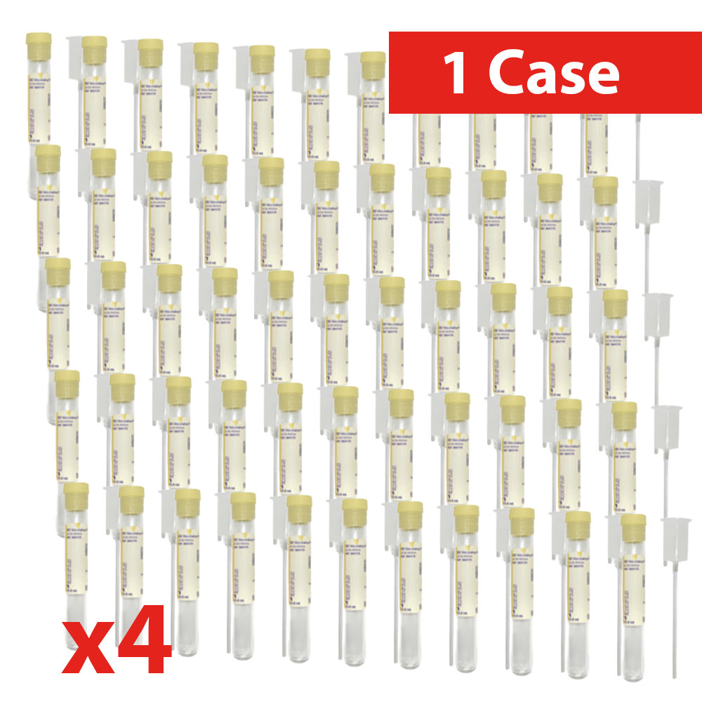 BD Vacutainer® Urine Collection Kit | 10 mL